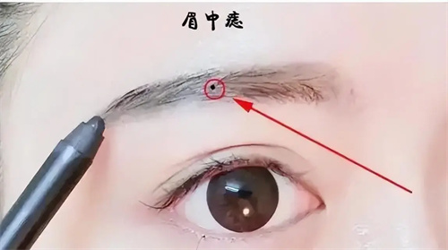 图片细节